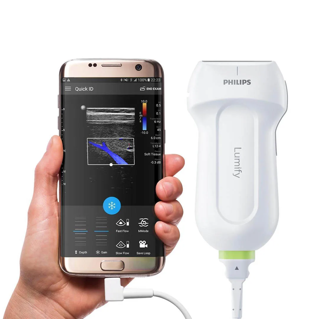 Ультразвуковая система Philips LUMIFY